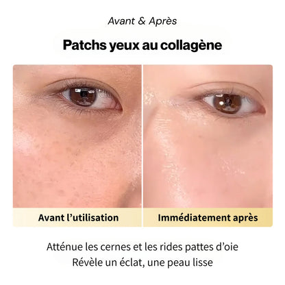 Patchs yeux au collagène