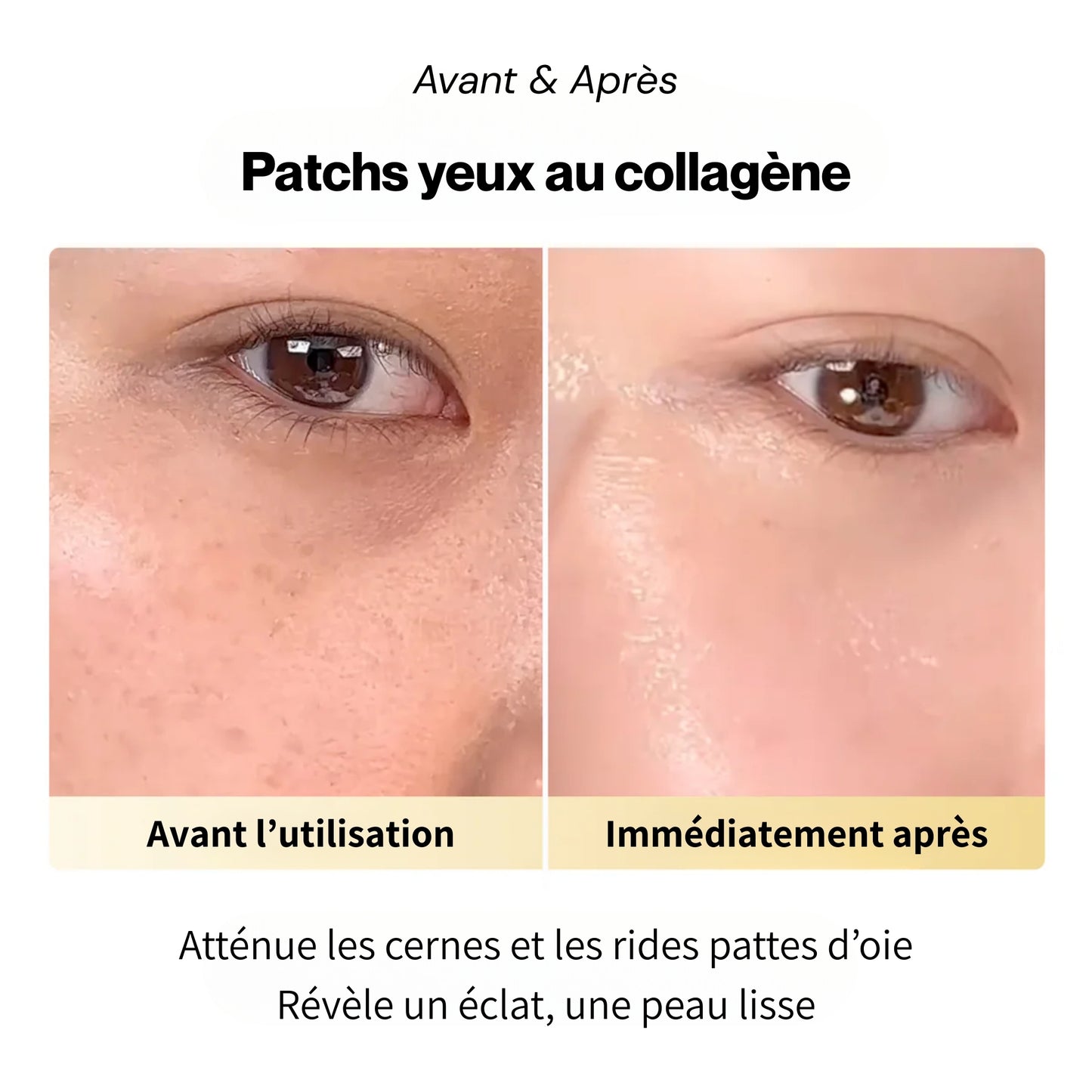 Patchs anti-cerne au collagène