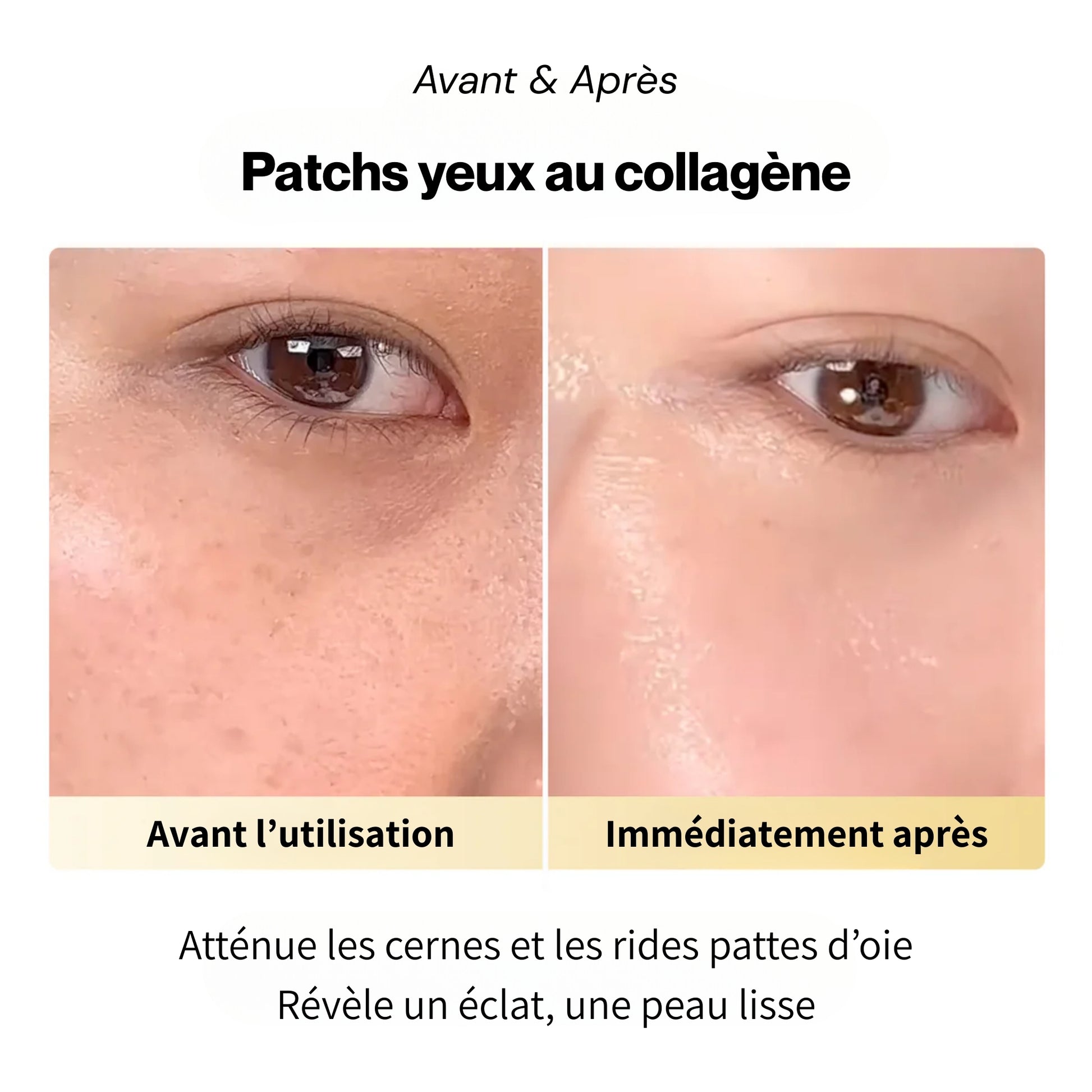 Patchs anti-cerne au collagène